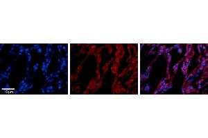 Rabbit Anti-TAP1 Antibody     Formalin Fixed Paraffin Embedded Tissue: Human Lung Tissue  Observed Staining: Cytoplasmic in alveolar type I & II cells  Primary Antibody Concentration: 1:100  Secondary Antibody: Donkey anti-Rabbit-Cy3  Secondary Antibody Concentration: 1:200  Magnification: 20X  Exposure Time: 0. (TAP1 antibody  (Middle Region))