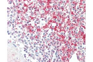 Anti-ADAM19 antibody IHC staining of human spleen. (ADAM19 antibody  (AA 574-588))