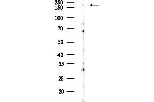 anti-Tensin 1 (TNS1) (C-Term) antibody