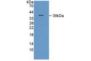 Western blot analysis of recombinant Rat ITaC. (CXCL11 antibody  (AA 22-100))