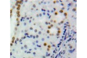 Used in DAB staining on fromalin fixed paraffin-embedded Kidney tissue (DNMT1 antibody  (AA 1343-1570))