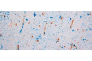 Immunohistochemistry (IHC) image for anti-G Protein-Coupled Receptor 39 (GPR39) (Extracellular Domain) antibody (ABIN1048812)