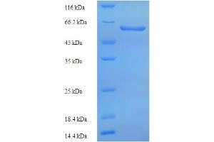 SDS-PAGE (SDS) image for Collagen, Type VI, alpha 6 (COL6A6) (AA 430-982) protein (His tag) (ABIN5714260) (Collagen, Type VI, alpha 6 (COL6A6) (AA 430-982) protein (His tag))