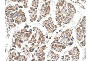 MOSPD3 antibody was used for immunohistochemistry at a concentration of 4-8 ug/ml to stain Skeletal muscle cells (arrows) in Human Muscle. (MOSPD3 antibody  (C-Term))