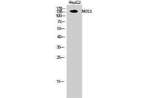 Western Blotting (WB) image for anti-Nitric Oxide Synthase 3 (Endothelial Cell) (NOS3) (Thr180) antibody (ABIN3185940) (ENOS antibody  (Thr180))
