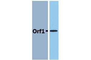 Western Blotting analysis (reducing conditions) of recombinant protein Orf1 in cell lysate of Orf1-transfected E. (Neisseria Meningitidis Antigen Orf1 antibody)