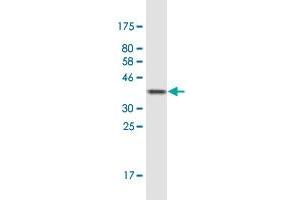 Western Blot detection against Immunogen (36. (IL1RL2 antibody  (AA 20-118))