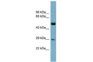 WB Suggested Anti-RAB27A Antibody Titration: 0. (RAB27A antibody  (Middle Region))