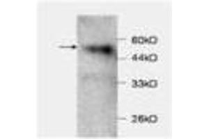 Image no. 1 for anti-Chemokine (C-C Motif) Ligand 2 (CCL2) antibody (ABIN791499) (CCL2 antibody)