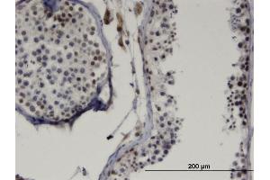 Immunoperoxidase of monoclonal antibody to LMX1B on formalin-fixed paraffin-embedded human testis. (LMX1B antibody  (AA 1-110))