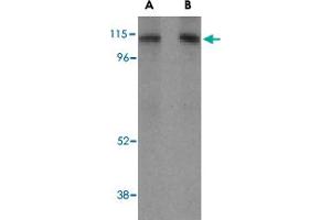 Western blot analysis of LAMP2 in HepG2 cell lysate with LAMP2 polyclonal antibody  at (A) 1 and (B) 2 ug/mL .