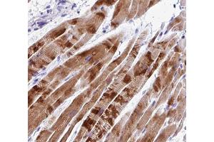 ABIN6266808 at 1/100 staining human Skeletal muscle tissue sections by IHC-P. (C2orf40 antibody  (C-Term))