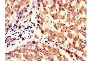 Immunohistochemistry of paraffin-embedded human liver tissue using ABIN7157253 at dilution of 1:100 (KBTBD6 antibody  (AA 1-139))