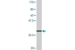 Western Blot detection against Immunogen (37. (MAGED2 antibody  (AA 16-125))