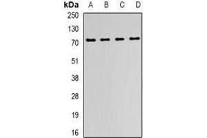 Western blot analysis of FMR1 expression in MCF7 (A), Jurkat (B), mouse kidney (C), mouse liver (D) whole cell lysates. (FMR1 antibody)