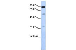 WB Suggested Anti-SENP5 Antibody Titration: 0. (SENP5 antibody  (Middle Region))