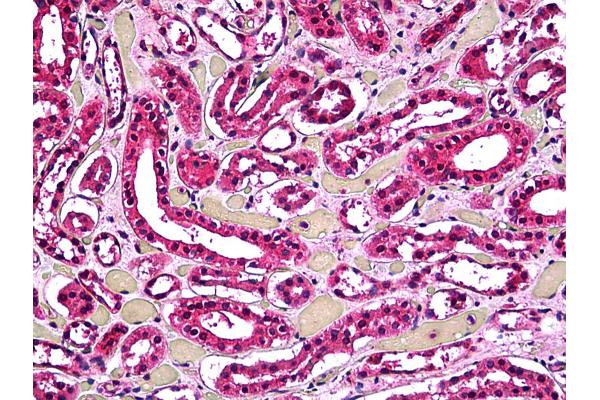 ACP2 antibody  (AA 1-424)