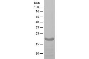 Western Blotting (WB) image for Matrix Metallopeptidase 9 (Gelatinase B, 92kDa Gelatinase, 92kDa Type IV Collagenase) (MMP9) (AA 532-707) protein (His tag) (ABIN7123861) (MMP 9 Protein (AA 532-707) (His tag))