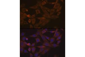 Immunofluorescence analysis of NIH-3T3 cells using Desmoglein 3 Rabbit mAb (ABIN7266741) at dilution of 1:100 (40x lens). (Desmoglein 3 antibody)