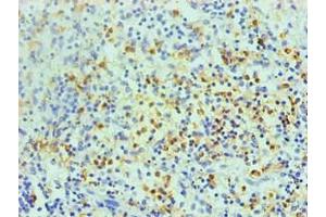Immunohistochemical of paraffin-embedded human spleen using ABIN7168559 at dilution of 1:200 (S1A8 antibody)