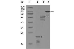 Western blot analysis using ERBB3 mouse mAb against truncated Trx-ERBB3 recombinant protein (1), MBP-ERBB3 (aa1175-1275) recombinant protein (2) and truncated ERBB3(aa665-1342)-hIgGFc transfected CH0-K1 cell lysate (3). (ERBB3 antibody  (AA 1175-1275))