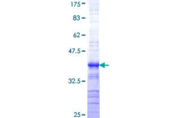 RNF10 Protein (AA 713-811) (GST tag)