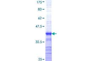 Image no. 1 for Ring Finger Protein 10 (RNF10) (AA 713-811) protein (GST tag) (ABIN1318182)