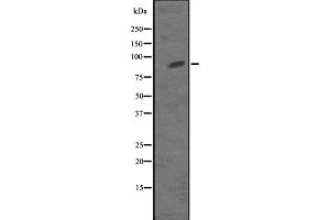 Western blot analysis of KIF23 expression in MKLP1 transfected 293T cell lysate,The lane on the left is treated with the antigen-specific peptide.