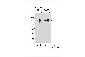 Western blot analysis of lysate from A431 cells(from left to right),untreated or treated with EGF at 100 ng/mL,using Phospho-EGFR-p Antibody  or EGFR-p Antibody. (EGFR antibody  (pSer768))