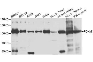Western blot analysis of extracts of various cell lines, using FOXM1 antibody (ABIN5971328) at 1/1000 dilution. (FOXM1 antibody)