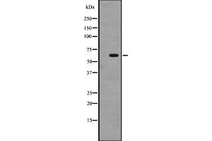 Western blot analysis of SRMS expression in A431 whole cell lysate ,The lane on the left is treated with the antigen-specific peptide. (SRMS antibody  (C-Term))