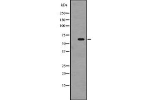 Western blot analysis of SRMS expression in A431 whole cell lysate ,The lane on the left is treated with the antigen-specific peptide. (SRMS antibody  (C-Term))