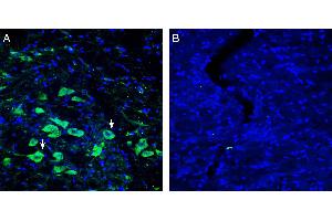 Expression of Platelet-activating factor receptor in rat substantia nigra pars compacta (SNC).