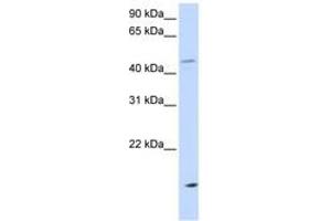Image no. 1 for anti-Cholesteryl Ester Transfer Protein (CETP) (AA 36-85) antibody (ABIN6743588)