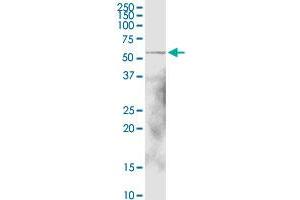 ALDH1A1 MaxPab rabbit polyclonal antibody. (ALDH1A1 antibody  (AA 1-501))