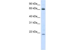 Western Blotting (WB) image for anti-Nuclear Import 7 Homolog (NIP7) antibody (ABIN2462264) (NIP7 antibody)