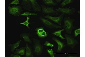 Immunofluorescence of purified MaxPab antibody to G6PD on HeLa cell. (Glucose-6-Phosphate Dehydrogenase antibody  (AA 1-515))