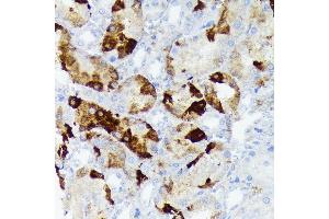 Immunohistochemistry of paraffin-embedded rat kidney using CRYAB Rabbit mAb (ABIN7266528) at dilution of 1:100 (40x lens). (CRYAB antibody)