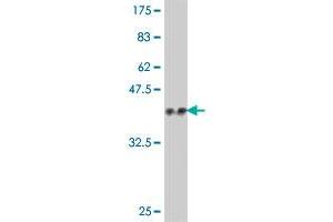 Western Blot detection against Immunogen (37. (PHF21A antibody  (AA 331-430))