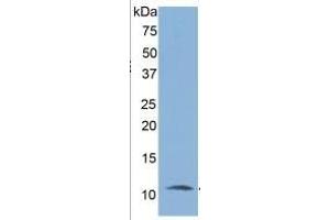 WB of Protein Standard: different control antibodies  against Highly purified E. (IL-6 Receptor ELISA Kit)