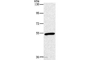 Western blot analysis of Mouse heart tissue, using OXTR Polyclonal Antibody at dilution of 1:866 (Oxytocin Receptor antibody)
