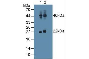 Figure. (Pituitary Adenylate Cyclase Activating Peptide (AA 17-176) antibody)