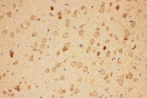 Immunohistochemistry (IHC) image for anti-Heat Shock Protein 90kDa alpha (Cytosolic), Class A Member 1 (HSP90AA1) (AA 2-365) antibody (ABIN3043847)