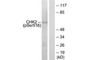 Western Blotting (WB) image for anti-Checkpoint Kinase 2 (CHEK2) (pSer516) antibody (ABIN2888383) (CHEK2 antibody  (pSer516))