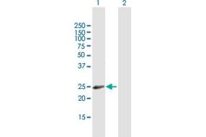 RAB31 antibody  (AA 1-195)