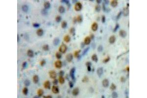 Used in DAB staining on fromalin fixed paraffin-embedded Kidney tissue (HMGB1 antibody  (AA 1-215))