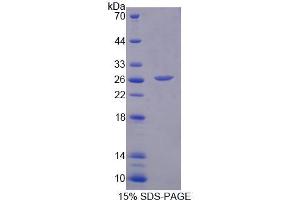 SDS-PAGE (SDS) image for Methylcrotonoyl-CoA Carboxylase 2 (Beta) (MCCC2) (AA 337-563) protein (His tag) (ABIN4989969)