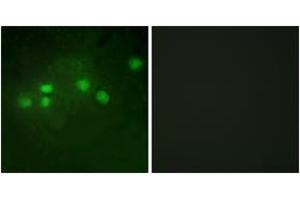 Immunofluorescence analysis of A549 cells, using ELF1 Antibody.