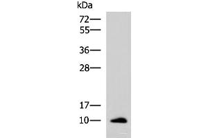 Western blot analysis of Human ileum tissue lysate using CCL13 Polyclonal Antibody at dilution of 1:700 (CCL13 antibody)