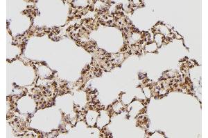 ABIN6269273 at 1/100 staining Rat lung tissue by IHC-P. (Tuberin antibody  (Internal Region))
